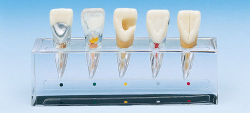 Anatomisches Modell / Dental - PE-END001 - Nissin Dental Products Inc.   - Wurzelkanal / für Endodontie / für die Ausbildung