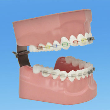Anatomisches Modell / Zahn - PE-ORT002 - Nissin Dental Products Inc.   - für die Zahnhygiene / für Kieferorthopädie / für die Ausbildung