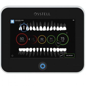 Monitor für Implantatstabilität / mit Touchscreen - Osstell IDx - OSSTELL AB  