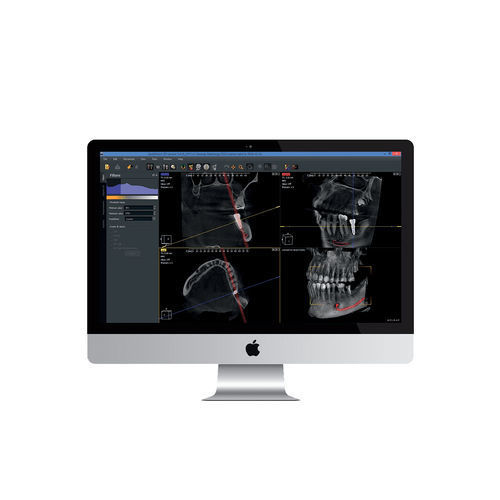 Fernröntgen-Software - Owandy Radiology - Diagnose / Mess / Behandlungsplanung
