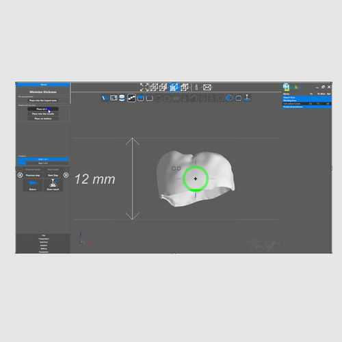 Visualisierungssoftware - PICASOFT SAS   - Dental / automatisiert / automatisiert