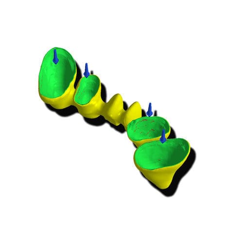 CAD-Software - Margin Line - PICASOFT SAS   - Dental / Gebiss