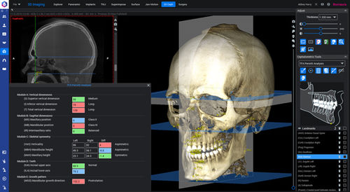 Fernröntgen-Software - Romexis®  - Planmeca - orthodontisch / 3D-Visualisierung / Mess