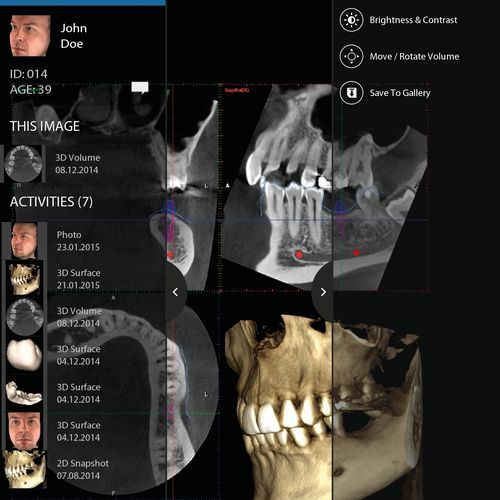 IOS-Applikation / Visualisierung - mRomexis™ - Planmeca - Erfassung / für Kliniken / Dental