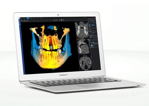 Web-Anwendung / Viewer - Romexis®  - Planmeca - medizinisch / Dental / Dental