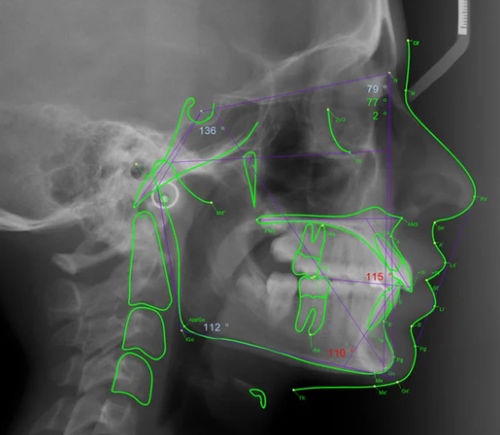 Fernröntgen-Software - Romexis® - Planmeca - Planung / Umform / medizinisch