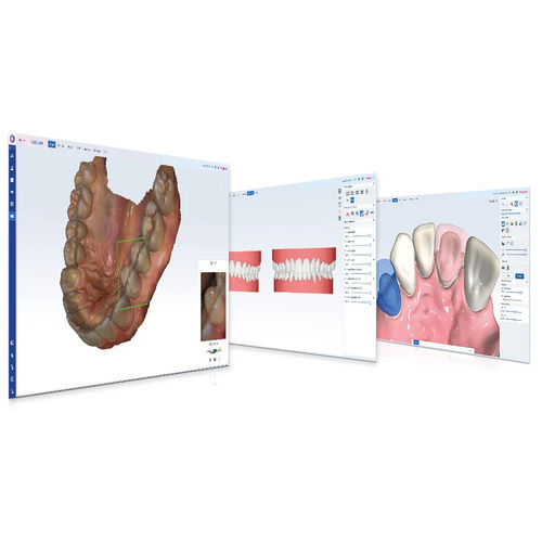 Software-Modul / Dental - Romexis® CAD/CAM - Planmeca - für dentale Bildgebung / für Kieferorthopädie / für Dentallabor