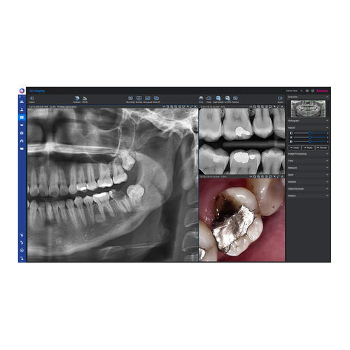 Analysesoftware - Romexis® - Planmeca - Diagnose / medizinisch / Dental