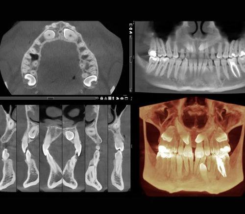 Medizinische Software - Romexis® 3D - Planmeca - für Chirurgie / Dental / für Endodontie