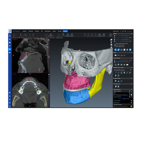 Medizinische Software - Romexis® CMF - Planmeca - für Chirurgie / für Kliniken / Visualisierung