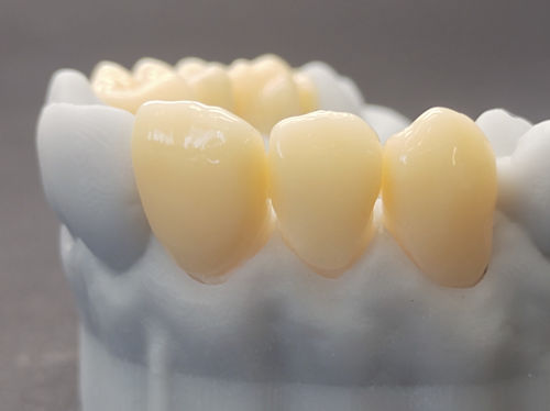 Zahnmedizinisches Material / PMMA - CORiTEC temp - pritidenta GmbH - zur Dentalrestaurierung / Fräs / für therapeutische Schienen