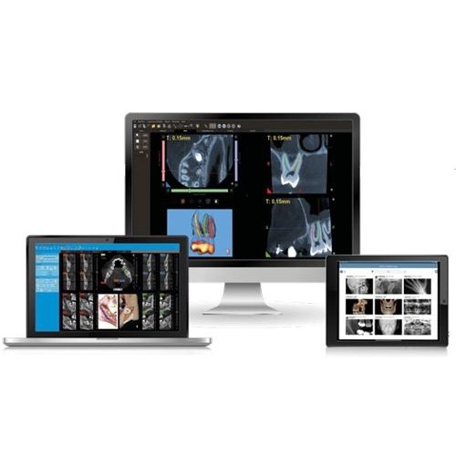 Management-Software - NNT - NewTom - Analyse / Diagnose / Umform