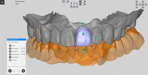 Dental-Software - RAYDENT designer - Ray - Projektentwicklung / für Tablet-PC