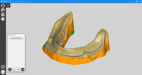 Dental-Software - RAYDENT tray - Ray - Projektentwicklung / Modellierung / für Tablet-PC