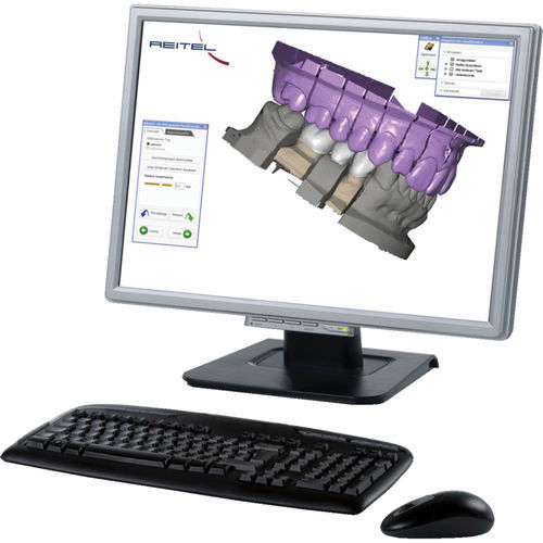 Projektentwicklungssoftware - Exocad®  - REITEL Feinwerktechnik - CAD / Planung / FAO