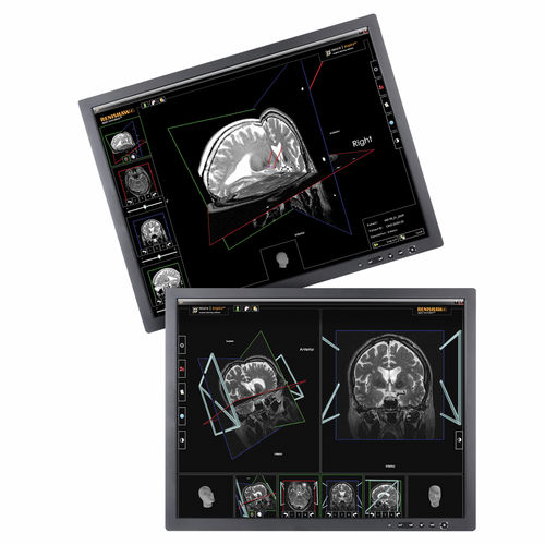 Software / Präoperative Planung - neuroinspire™ - Renishaw - medizinisch / für stereotaktische Neurochirurgie / automatisiert