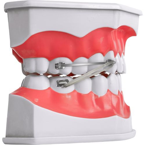 Orthodontie Bracket / Metall - SIA ORTHODONTIC MANUFACTURER