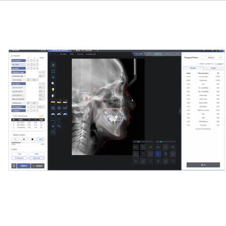 Fernröntgen-Software - WillCeph Pro - HDX Will - Projektentwicklung / orthodontisch
