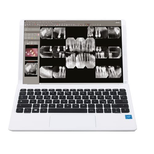 Dental-Software - iRYS - Stern Weber - Management / Steuerung / Viewer