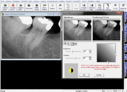 Bilderfassungssoftware - Prof. Suni - Suni Medical Imaging - Datenverwaltung / Diagnose / für dentale Bildgebung
