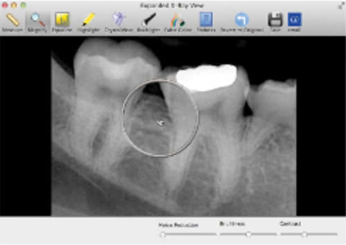 Datenverwaltungssoftware - SuniMac - Suni Medical Imaging - Bilderfassung / für dentale Bildgebung