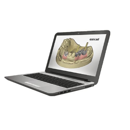 Software für Kliniken - exocad - TBR Implants Group - für Dentallabor / Projektentwicklung / CAD