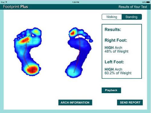 Datenverwaltungssoftware - Footprint Plus™ - Tekscan - Visualisierung / Bewertung / Podologie