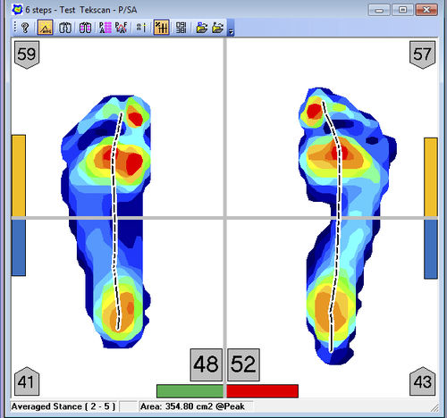 Podologie-Software - FootMat™ Researchers - Tekscan - Analyse / Visualisierung / Reporting