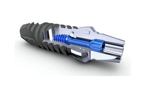 Implantat-Abutment / Titan - Thommen Medical AG   - inneres Sechseck / gerade