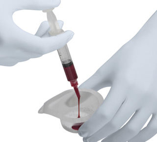Synthetisches Knochenersatzmaterial - Ceros® TCP  - Thommen Medical AG   - für orthopädische Chirurgie / Paste