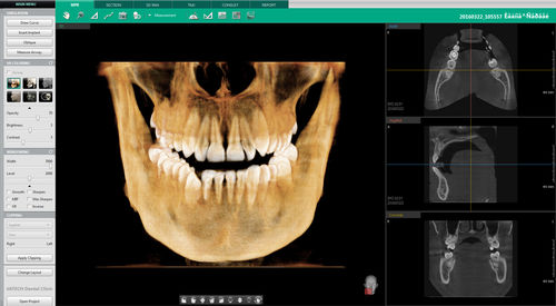 Dental-Software - Ez3D-i™ - VATECH Networks - für dentale Bildgebung / Analyse / Diagnose