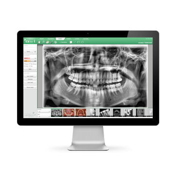 Software für dentale Bildgebung - EzDent-i™ - VATECH Networks - Datenanalyse / Bildanalyse / Reporting