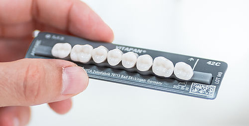 Verbundwerkstoff-Zahnprothese - VITAPAN® CUSPIFORM - VITA Zahnfabrik H. Rauter GmbH & Co.KG   - für Seitenzähne