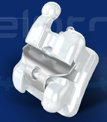 Selbstabklemmendes Orthodontie Bracket - SELPRO A - WORLD BIO TECH   - Keramik / rund / schmal