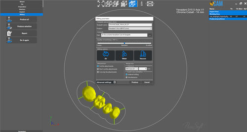 Dental-Software - Yenadent Cam 5.1 - Yenadent - Kalibrierung / CAD / FAO