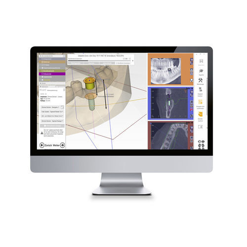 Visualisierungssoftware - CAD Software - Zfx GmbH - Projektentwicklung / CAD / medizinisch