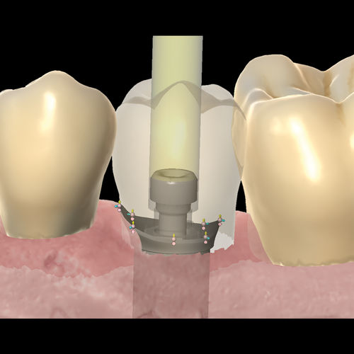 Software-Modul / für Dentallabor - Reality Mode - Zirkonzahn - für Zahnprothese-Design / 3D-Visualisierung / FAO