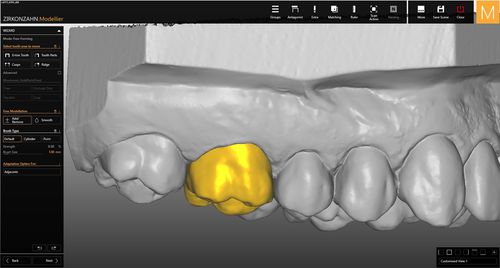 Software-Modul / für Dentallabor - Zirkonzahn