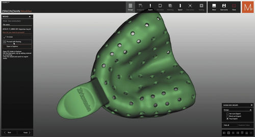 3D-Simulation-Software - Zirkonzahn