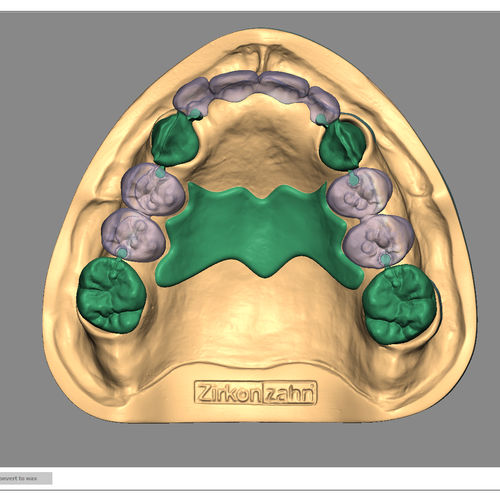 Software zur Dentalrestaurierung - Partial-Planner - Zirkonzahn - Import / 3D-Simulation / für Zahnprothese-Design