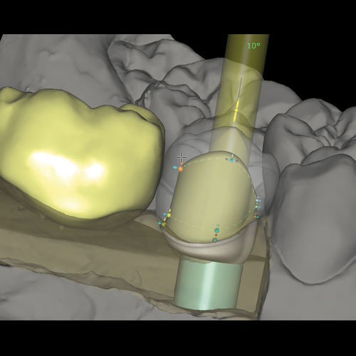 Software-Modul / für Zahnprothese-Design - CAD/CAM Abutments - Zirkonzahn - Fertigung / für Dentallabor