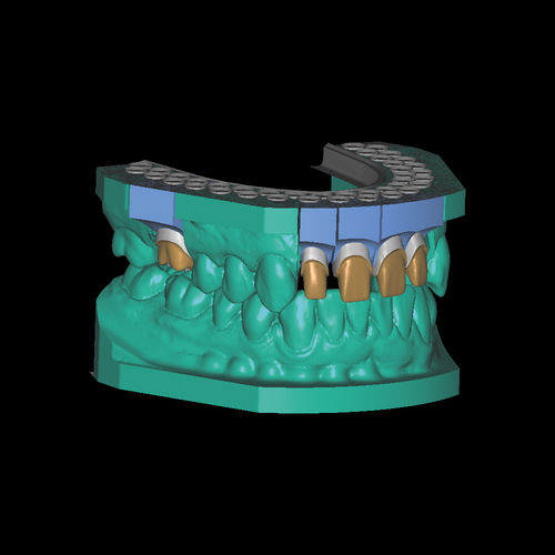 Software-Modul / Modellierung - Model-Maker - Zirkonzahn - 3D-Simulation / CAD / FAO