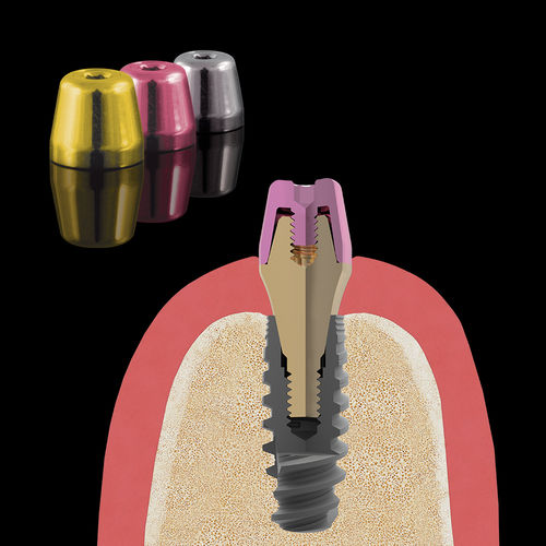 Einheilkappe für Mehrfach-Abutments - Zirkonzahn