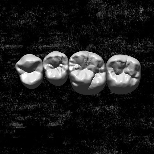 Software zur Dentalrestaurierung - Library - Zirkonzahn - 3D-Simulation / CAD / FAO