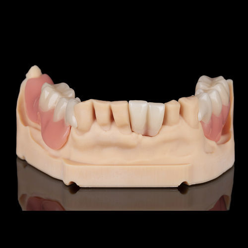 Harz-Zahnprothese - Flexmon Partials - Zirkonzahn - nach Maß / abnehmbar