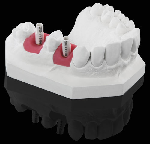 Weißer Scankörper - White Scanmarker - Zirkonzahn - intraoral