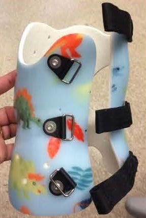 Stützkorsett / Brust Lendenwirbelsäule und Kreuzbein - Boston Orthotics + Prosthetics - für Kinder / für Skoliose