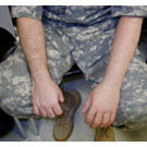 Kosmetische Handprothese - Boston Orthotics + Prosthetics - für Erwachsene