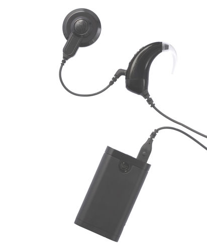 Hinter-dem-Ohr-Prozessoren-Cochleaimplantat - Hangzhou Nurotron Biotechnology