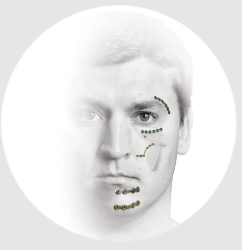 Kompressionsplatte für Unterkiefer - TraumaOne™ - Zimmer Biomet - für Gesichtsskelett / mit Verriegelung / Metall